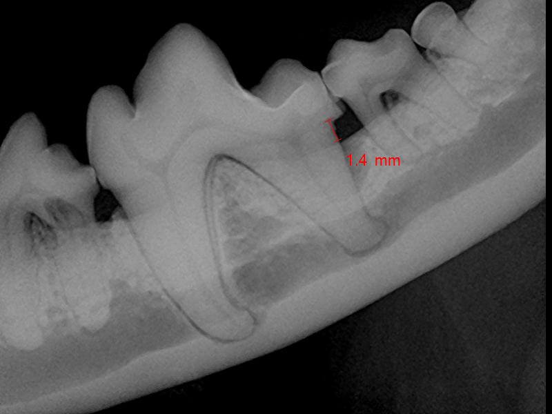 Digital Dental X-Ray 