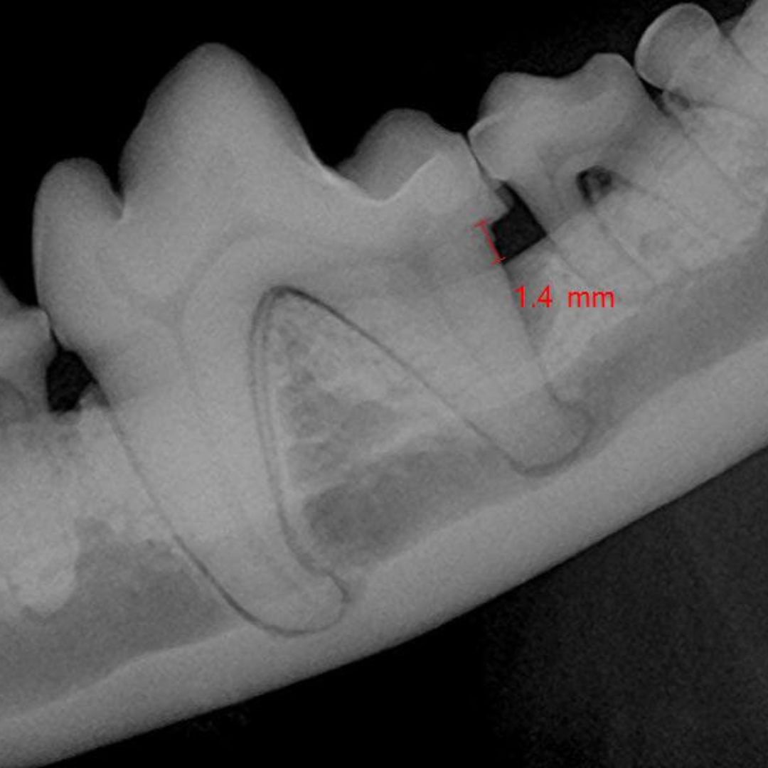 dental radiograph